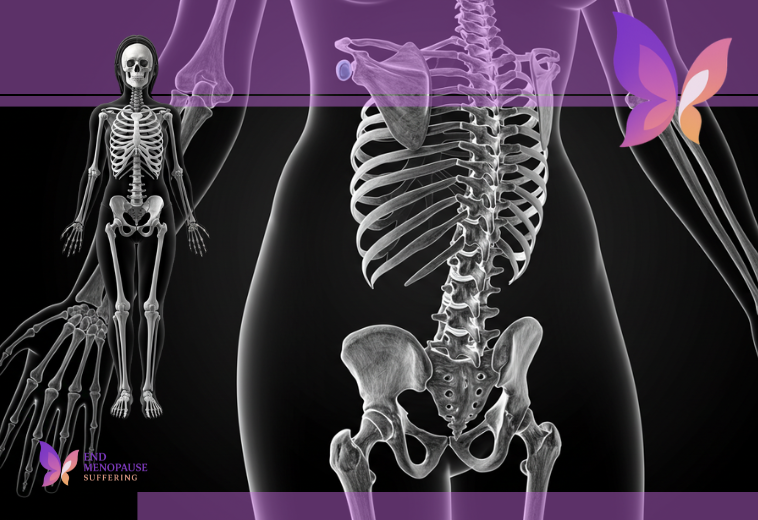 Bone Health in Menopause